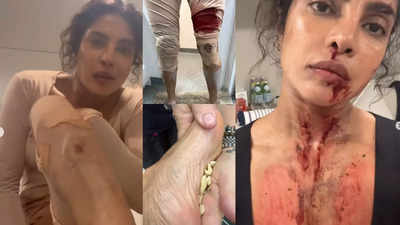 Priyanka Chopra: हॉलिवूड सिनेमाच्या शूटिंगमध्ये पुन्हा रक्तबंबाळ झाली प्रियांका, देसीगर्लनं केला देसी जुगाड