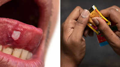 Tobacco छोड़ना चाहते हैं, छूट नहीं रही? WHO की ये 5 बातें मान लीजिए गाल सड़ने से बच जाएंगे