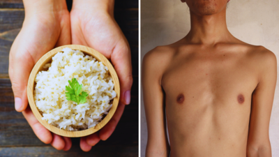Best Rice In India: कुपोषित शरीर में जान भर देगा ये चावल, FSSAI ने बताया ताकत की देसी दवा