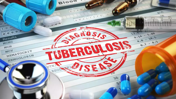 ​டிபி என்னும் காசநோய் (tuberculosis)