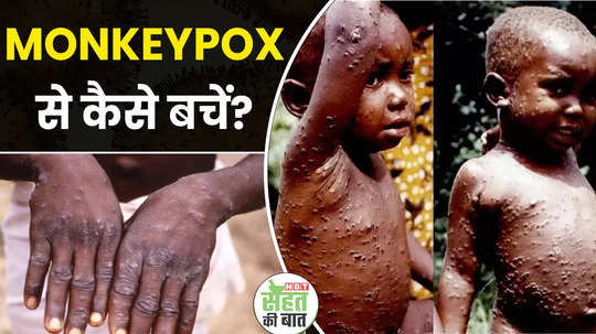 effective tips to prevent from monkeypox watch video