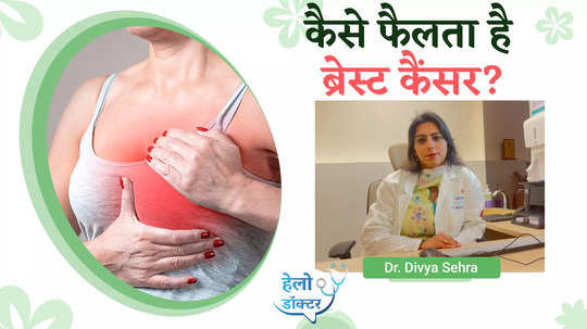 how does breast cancer occur and how many stages does it have know from dr divya sehra watch video