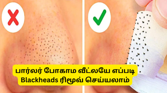 How To Remove Blackhead At Home : கரும்புள்ளிகளை அடியோடு நீக்க உங்க கிட்சனில் உள்ள 7 பொருள்கள் இதோ