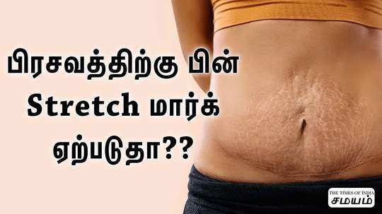 how to remove stretch marks the home remedies for remove stretch marks