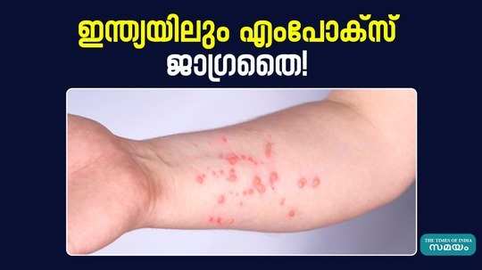 mpox symptoms causes and treatment