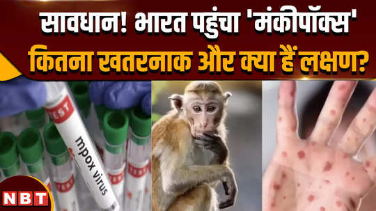 monkeypox in delhi what is monkeypox where did it come from know the answer to every question