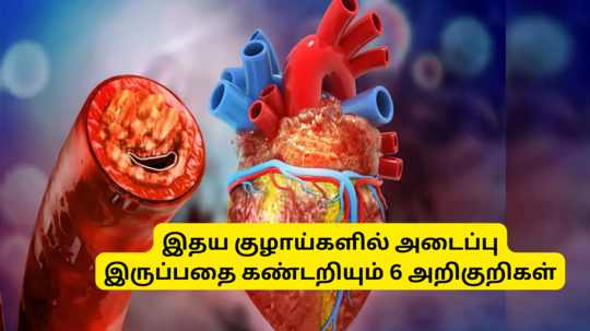 6 Heart Blockage Symptoms : இதயக் குழாய்களில் அடைப்பு இருப்பதை கண்டறிவது எப்படி? இந்த 6 அறிகுறிகள் இருக்கானு பாருங்க