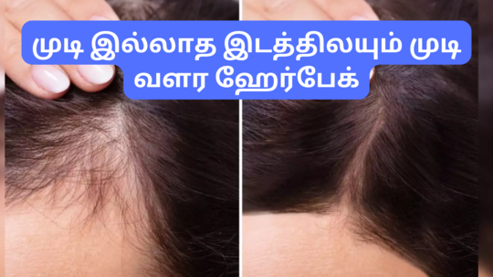 Amla Curry Leaves For Hair Growth : முடி கருகருனு சொட்டையா இருக்கற இடத்துலயும் கொத்து கொத்தா வளர இந்த ஹேர்பேக் போடுங்க