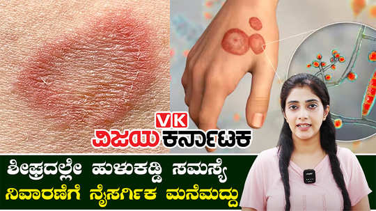 home remedies for ringworm