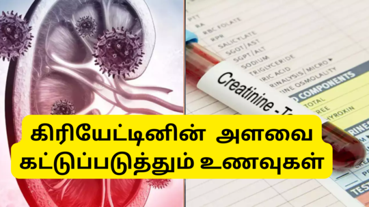 Foods For Reduce Creatinine Level  : கிரியேட்டினின் அளவு ரொம்ப அதிகமா இருக்கா - அப்போ நீங்க சாப்பிட வேண்டிய உணவுகள் இவைதான்