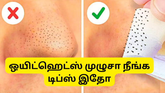 Tips To Remove Whiteheads On Nose : ஒயிட்ஹெட்ஸ் மூக்குமேல நிறைய இருக்கா இந்தாங்க உங்களுக்கு தான் சிம்பிள் டிப்ஸ்