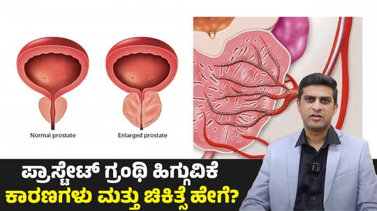 enlarged prostate symptoms and causes