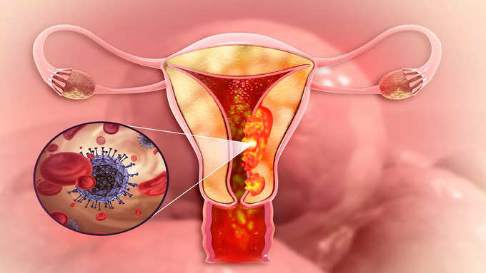 புற்றுநோயை எதிர்த்து போராடும் கருஞ்சீரகம்