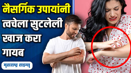 natural home remedies to stop itching and burning of the skin how to keep skin cool and dry in marathi watch video