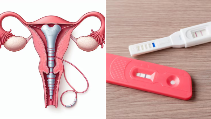 कैसे पहचाने IUD जगह से हट गया है?