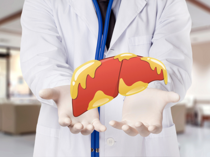 fatty liver causes