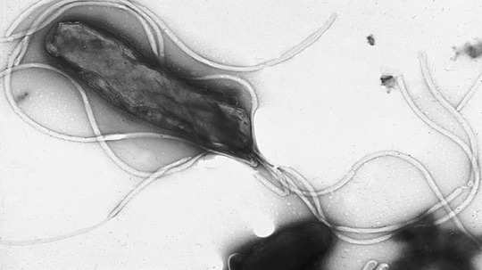 helicobacter Pylori Infection : जठरात जगणारा जीवाणू