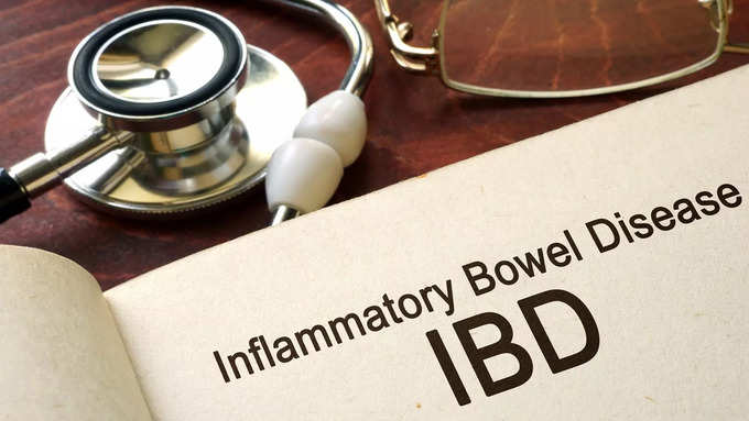 சிறுநீர் சளி வெளிவர எரிச்சல் கொண்ட குடல்நோய்க்குறி (IBS)