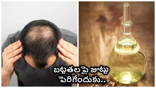 ఆముదంలో వీటిని కలిపి రాస్తే బట్టతల ప్యాచెస్‌పై కూడా జుట్టు పెరుగుతుందట