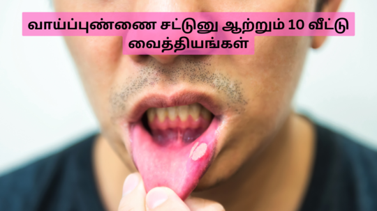 பனியில உதடு வறண்டு வாய்ப்புண் வந்துடுச்சா - கைமேல பலன் கொடுக்கும் 10 வீட்டு வைத்தியங்கள்