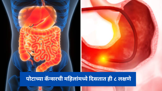 पोटाच्या कॅन्सरची महिलांमध्ये दिसतात ही ८ लक्षणे, गंभीर होण्यापूर्वीच डॉक्टरकडे धाव घ्या नाहीतर मृत्यू अटळ