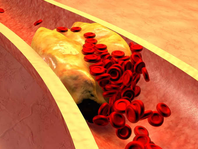 cholesterol (1)