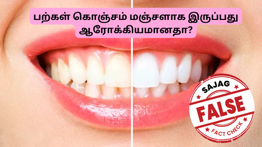 Fact Checking About Yellow Teeth : பற்கள் வெள்ளையா இருக்கறது ஆரோக்கியமா? மஞ்சளா இருக்கறதா? டாக்டர் உடைக்கும் உண்மை இதோ!