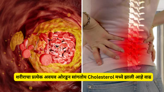 शरीराचा प्रत्येक अवयव ओरडून सांगतोय Cholesterol मध्ये झाली आहे वाढ, दुर्लक्ष केल्यास होईल मृत्यू