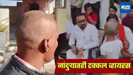 Buldhana Hair Loss: शेगाव पाठोपाठ नांदुऱ्यातही टक्कल व्हायरसचा शिरकाव, केस गळतीचे सात संशयित रुग्ण आढळल्याने खळबळ