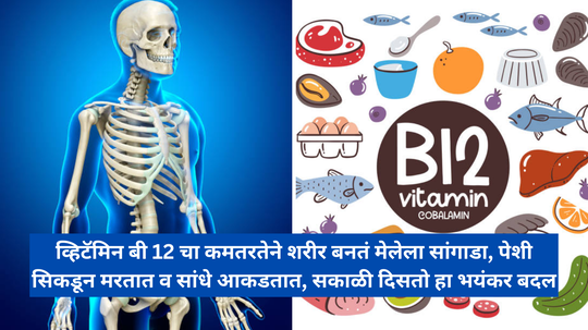 व्हिटॅमिन बी 12 चा कमतरतेने शरीर बनतं मेलेला सांगाडा, पेशी सिकडून मरतात व सांधे आकडतात, सकाळी दिसतो हा भयंकर बदल