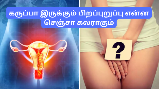 பிறப்புறுப்பு கருப்பா இருக்கா? வெள்ளையாக்க க்ரீம் தேடி அலையாதீங்க இந்த வீட்டு வைத்தியத்தை செஞ்சாலே போதும்