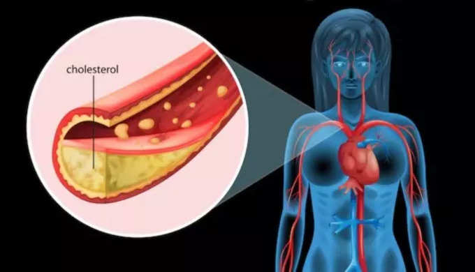 कोलेस्ट्रॉल क्या होता है?
