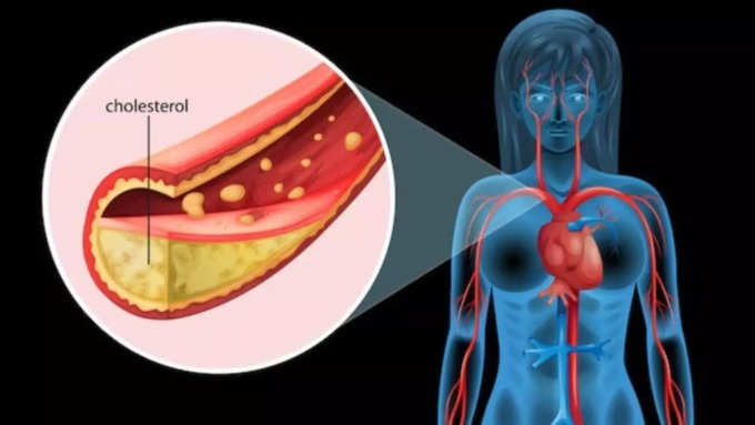क्या होता है कोलेस्ट्रॉल