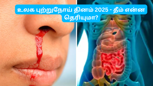 உலக புற்றுநோய் தினம் 2025-ம் ஆண்டுக்கான குறிக்கோள் என்ன? பொதுவாக அதிகம் பேரை பாதிக்கிற புற்றுநோய்கள் என்னென்ன