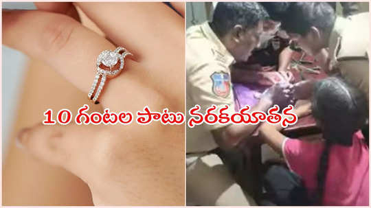 చిన్నారి వేలికి ఇరుక్కున్న ఉంగరం.. చేతులెత్తేసిన డాక్టర్లు.. చివరకు ఏం చేశారంటే..?