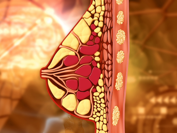 कई चीजों पर निर्भर करती है ब्रेस्ट सर्जरी