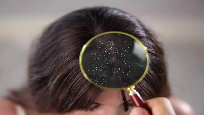 ஷாம்புவில் நியாசினமைடு உள்ளதா