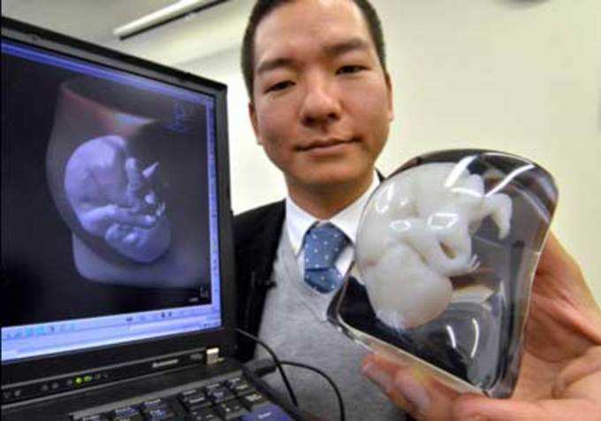भ्रूण की 3D फोटो