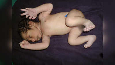 कुदरत का करिश्मा, 24 उंगलियों के साथ जन्मा बच्चा