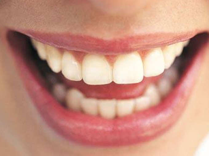 दांतों के ये 6 प्रकार, जो खोले आपके राज