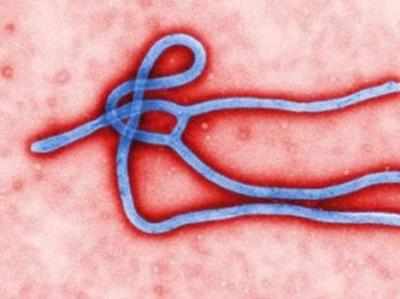 इबोला का दूसरा केस हेल्थ वर्कर