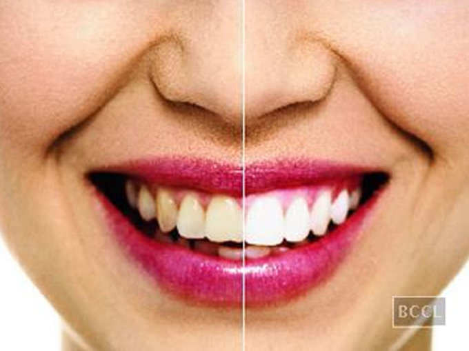 क्या दांत चमकाने वाले टूथपेस्ट अच्छे होते हैं?