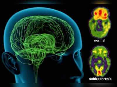 যে লক্ষণে বুঝবেন, এটা ডিপ্রেশন নয় আসলে স্কিত্‍‌‌জোফ্রেনিয়া