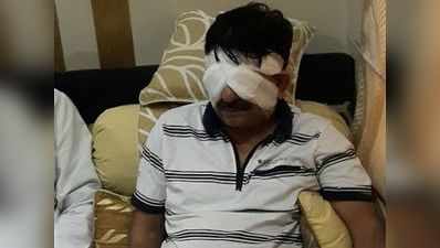 BJP विधायक पर बदमाशों ने मिर्च पाउडर से किया हमला