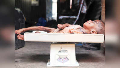 वाडा में कुपोषण से एक और बच्चे की मौत