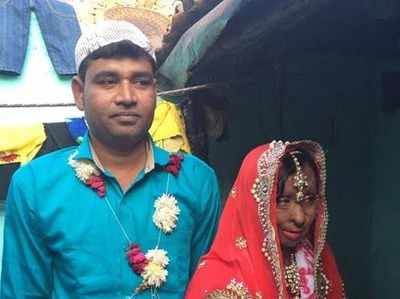 कानपुर में एसिड अटैक पीड़िता से पड़ोस के युवक ने की शादी