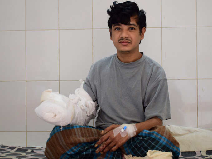 16 ऑपरेशन के बाद हुआ बांग्लादेश के ट्री मैन का इलाज