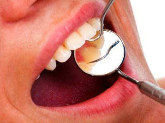 टूथपिक के इस्तेमाल से दांतों को हो सकता है नुकसान