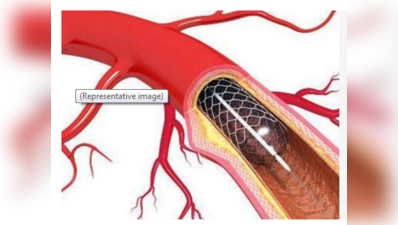 ইউরোপের তুলনায় ভারতে স্টেন্টের দাম কয়েক গুণ বেশি!