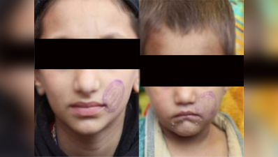 बच्चों के चेहरे पर स्टाम्प लगाने वाली गार्ड निलंबित